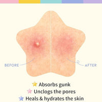 180 Pcs Pimple Patches